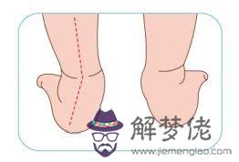 小孩走路內八字