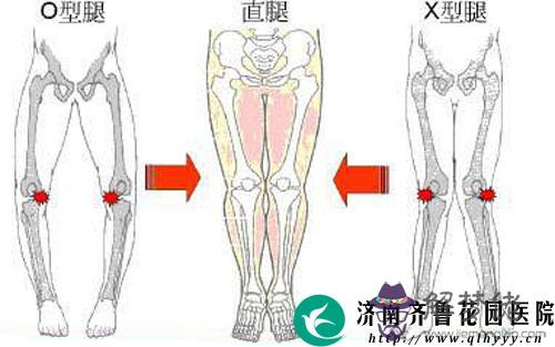 走路內八字的人性格：為什麼有的人走路腳步聲沒有