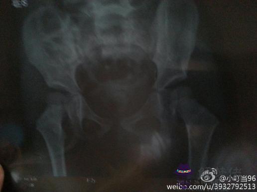 2歲寶寶一只腳內八字：熊貓吃什麼