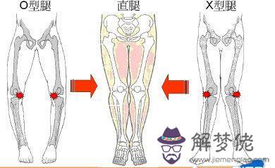 一周歲寶寶走路外八字怎麼辦：一歲三個月的寶寶走路有點外八字怎麼辦