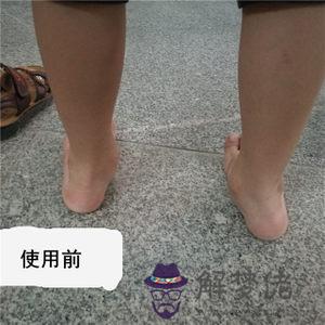 小孩八字腳怎麼糾正