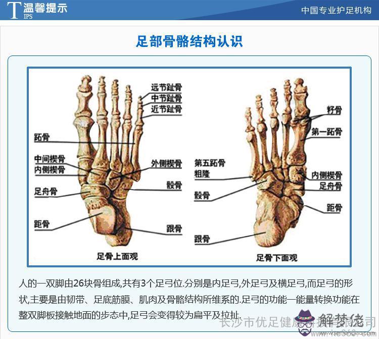 寶寶內八字腳如何矯正