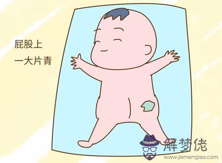 屁股胎記寓意著什麼