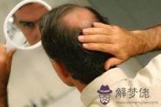 頭頂地中海會帶來什么運勢改變呢