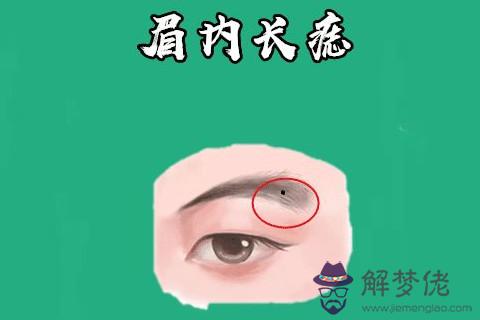 旺財痣有哪些？