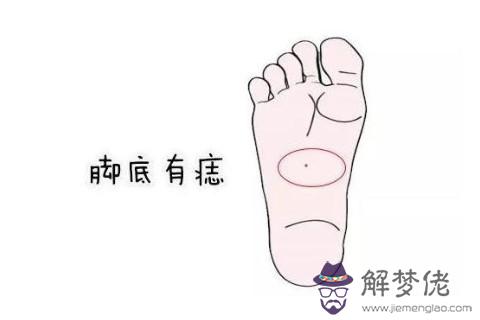 右腳底有痣代表了什麼？
