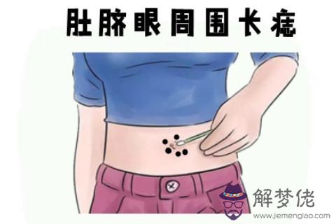 女人生貴子痣長在什麼位置