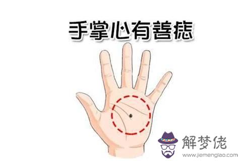 手掌金星丘有痣好不好？