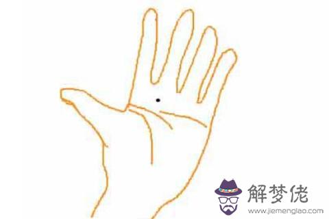 手掌中央有黑痣