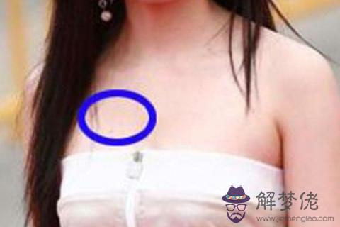 女人rufang有痣好不好