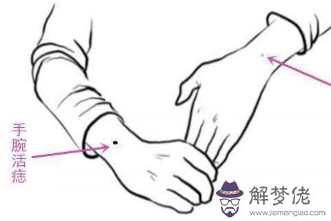 手腕長痣的人命運好不好