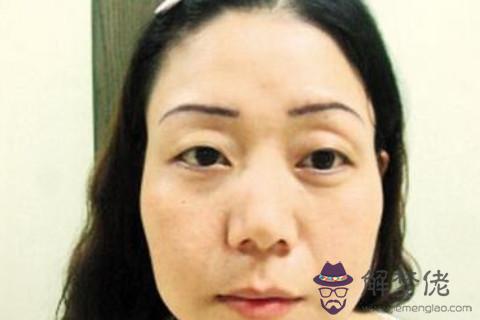  大小不一致眼睛的面相代表什麼？