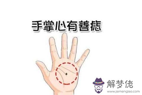 女生手有痣有什麼含義 代表著什麼