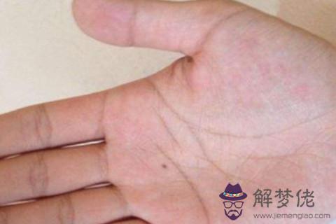 女人身上長痣好不好 富貴痣長在哪里