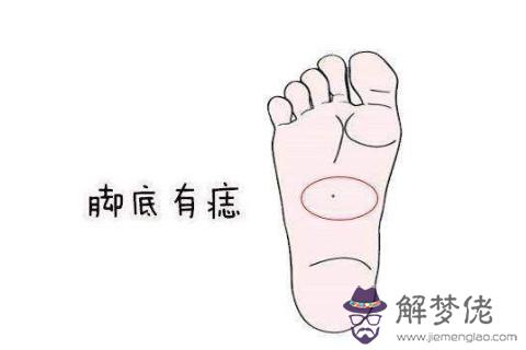 面相分析：男人女人腳底有一顆痣是有什麼說法