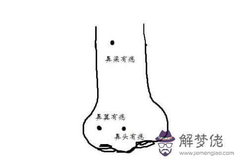 面相：鼻子有痣有著什麼意思呢？