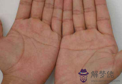 雙手斷掌的男人命苦