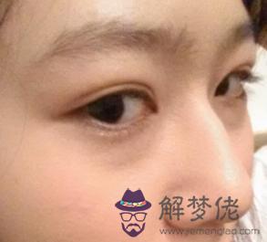 女人駝峰鼻的面相代表著什麼,對人體有沒有影響(圖文)