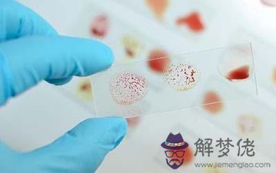 o型血和b型血生的孩子是什麼血型呢