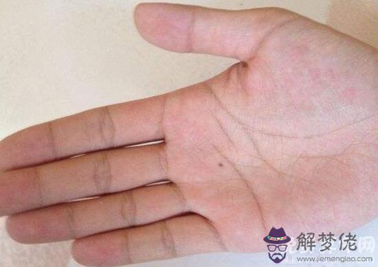 手上不同位置長痣的含義，手背上長痣會有貴人相助