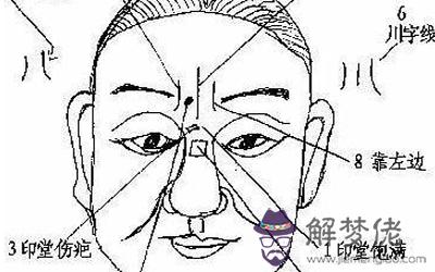 三痣相連有什麼解釋？(圖文)