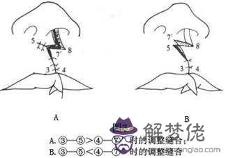 裂唇和八字有關嗎