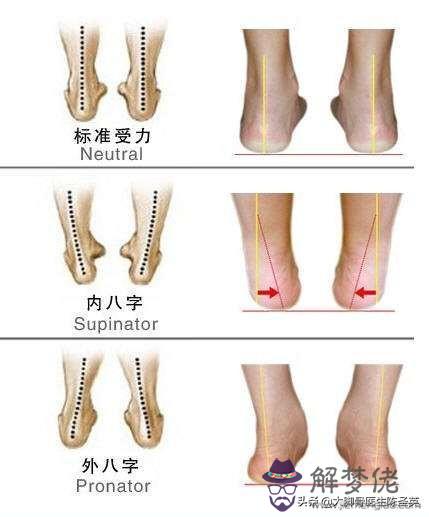 六歲小孩內八字怎麼矯正