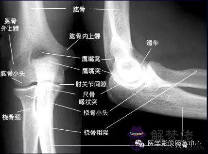 肘關節脂肪墊八字