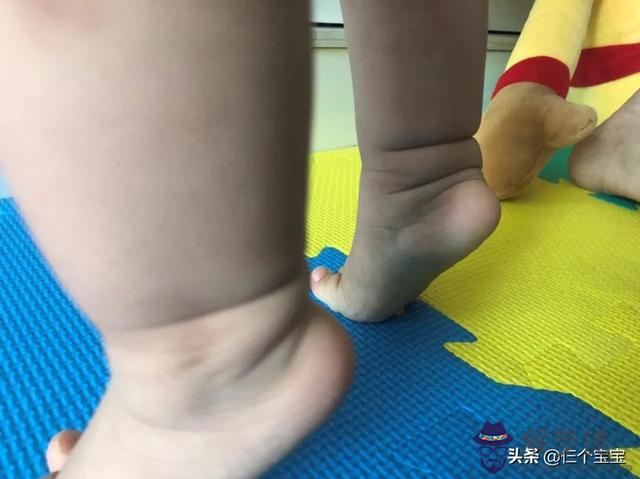 女生走路外八字腳原因