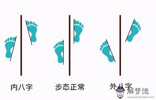 前段時間發現走路內八字