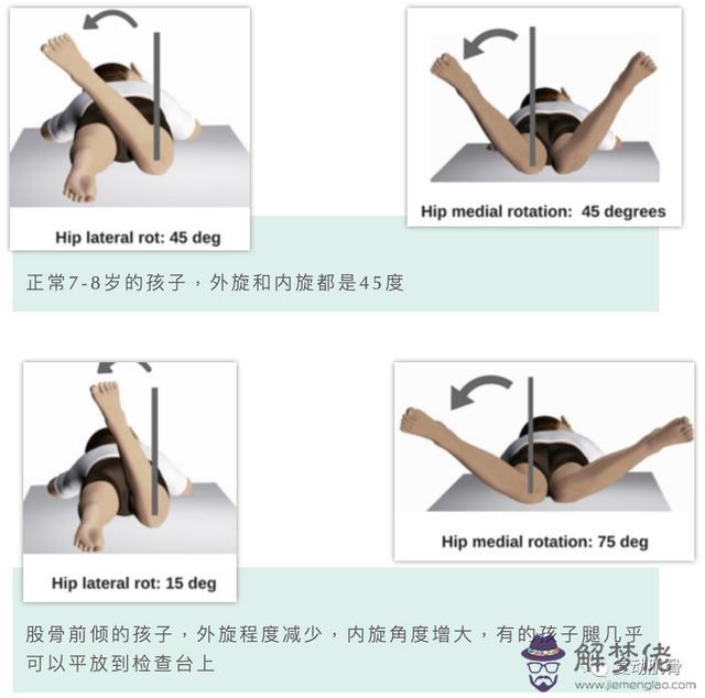 八歲內八字怎麼治療 八歲內八字怎麼治療