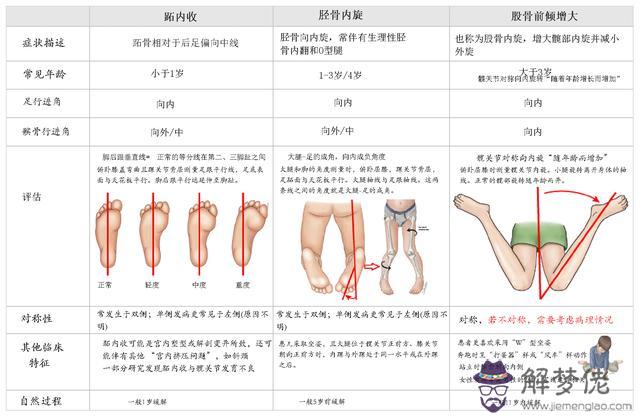 幼兒腿直但走路內八字