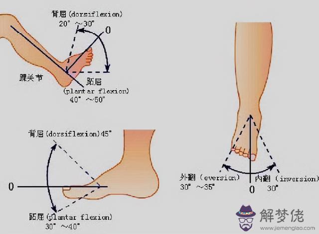 成年外八字腳應該怎麼矯正呢