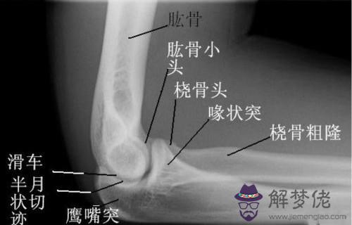 眼睛下方有條八字溝叫什麼