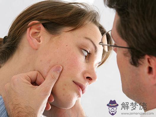 算命說女人上嘴唇有疤痕什麼意思