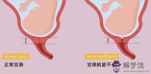 算命孕安是什麼意思 算命孕安是什麼意思