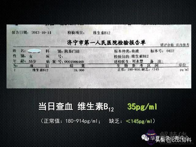 脊髓亞急性聯合變性八字征