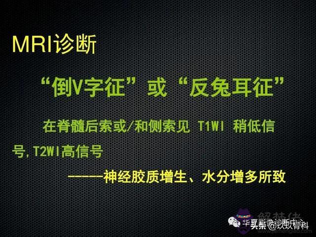 脊髓亞急性聯合變性八字征