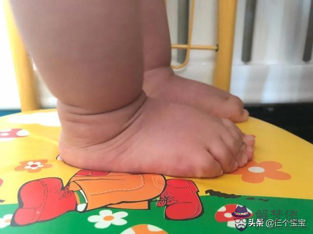 一周歲小女孩學步時一只腳外八字