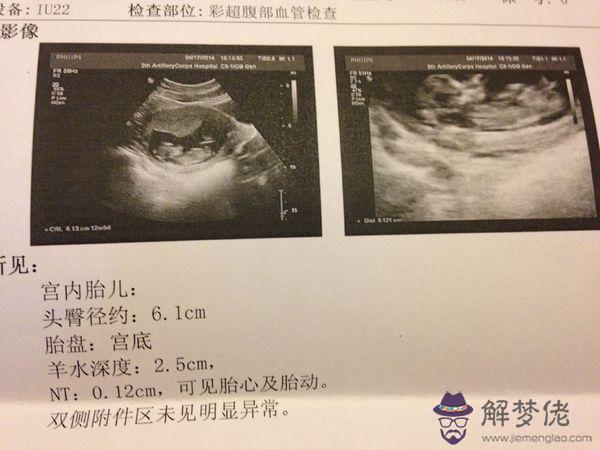 2、免費測試自己生兒子還是女兒:測生兒子還是女兒