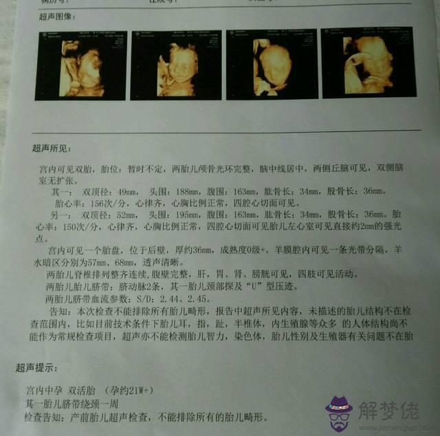 4、四維確認女寶b超圖:一張四維彩超加一個b超求好心人看看，一直很好奇是閨女還是兒子