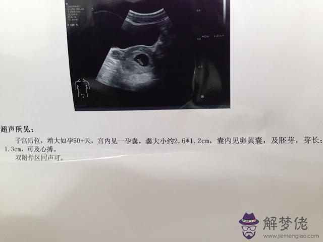 1、懷孕多久可以看出性別:有沒有去驗血檢查男孩生出來是女孩的