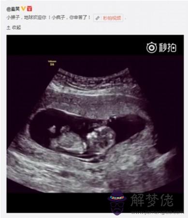 1、懷孕八周b超參照:生男生女，懷孕7周3天