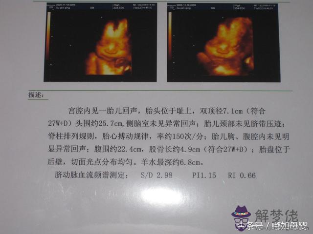 1、四維彩超做出來是女孩準嗎:四維彩超孩子是男孩嗎