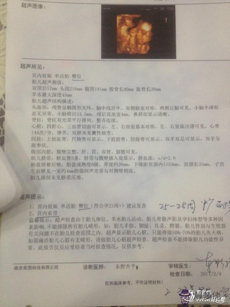 4、兩胎女兒三胎男孩概率:前兩胎生的女孩子,三胎生男孩子的概率