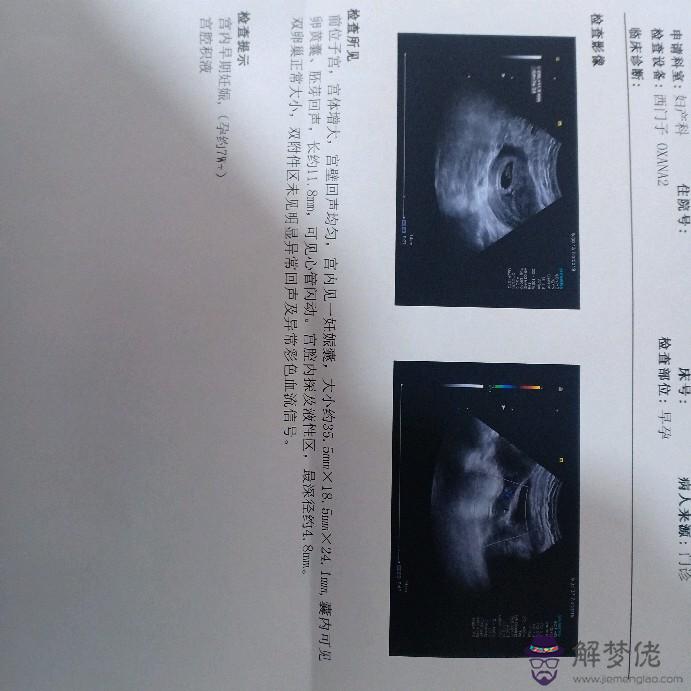 9、兩胎女兒三胎男孩概率:前兩胎兒子三胎懷女孩概率