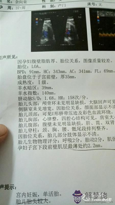 8、兩胎女兒三胎男孩概率:一個婦女前三胎生的女兒第三胎生男孩的概率是多少