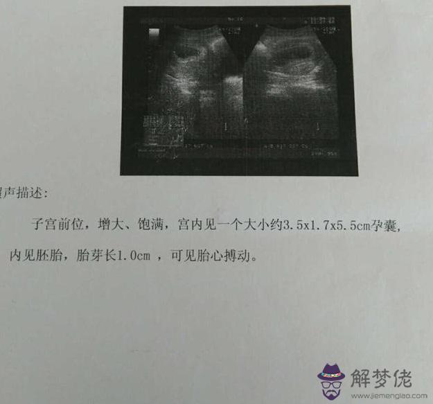 10、兩胎女兒三胎男孩概率:前兩胎女兒第三胎兒子概率