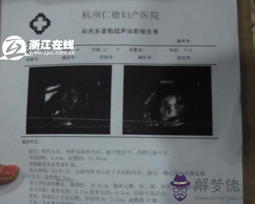 1、四維彩超報告單解讀:四維彩超單怎麼看是男孩還是女孩？