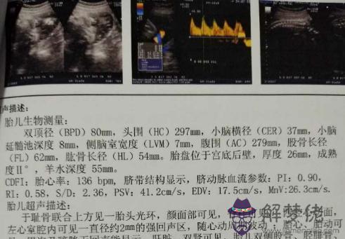 4、懷女孩都有哪些明顯癥狀:懷女孩特征有哪些